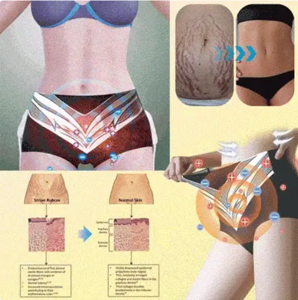 Orvosi minőségű titánszálas önmelegedő turmalin formájú rövidnadrág