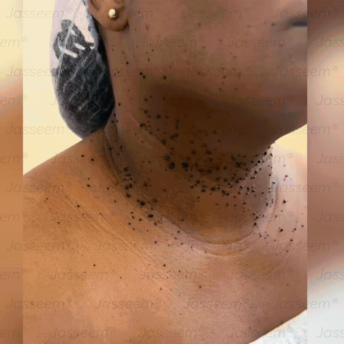 𝐉𝐚𝐬𝐬𝐞𝐞𝐦® Fejlett, nem invazív bőrjavító CO₂ lézeres toll 🎉 (Gyengéden eltávolítja a szemölcsöket, anyajegyeket, öregségi foltokat és bőrkinövéseket – fájdalom és gond nélkül!)