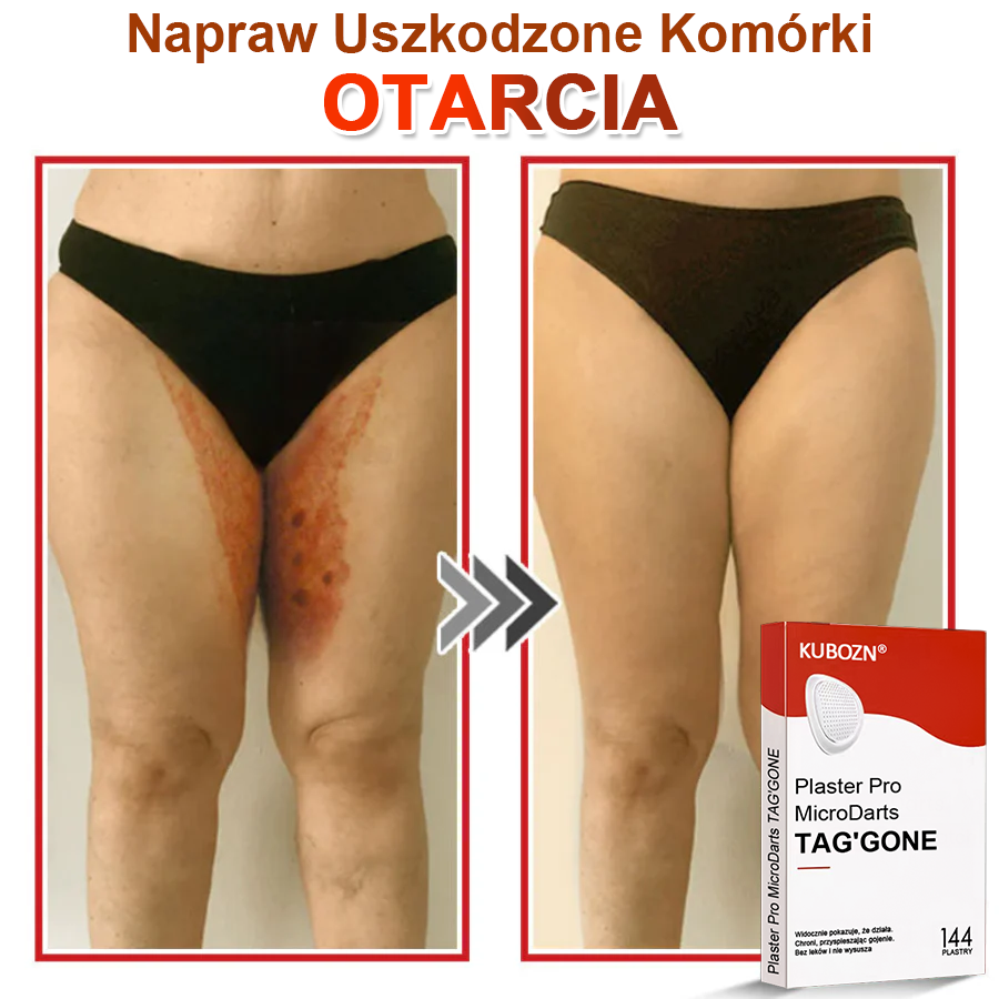 🌈 KUBOZN® mikrotűs botanikai tapasz a bőr szemölcseinek eltávolítására