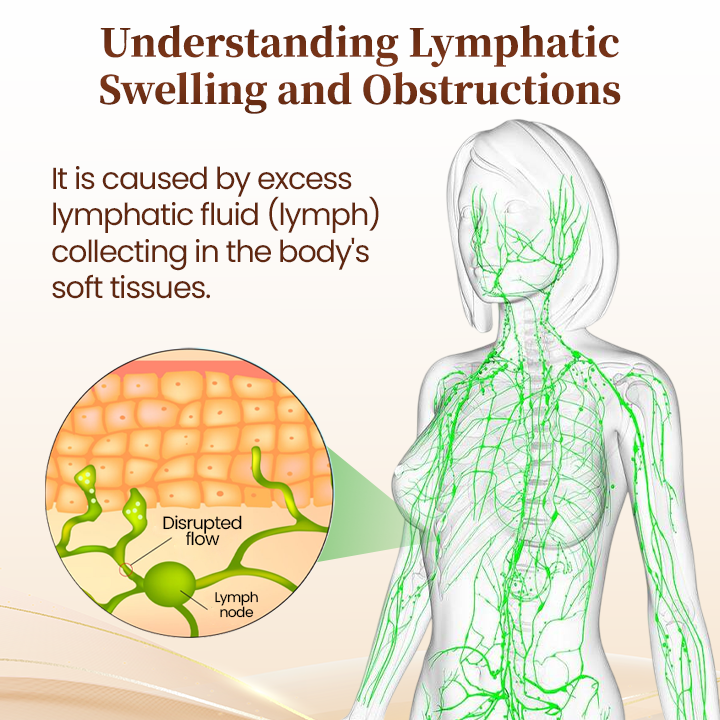 LymphAura germánium méregtelenítő fülbevaló (USA-ból importálva) -🌟Vásároljon 1-et, kap 1-et (🇮🇳Köztársaság Napja🇮🇳 ajánlat)🌟