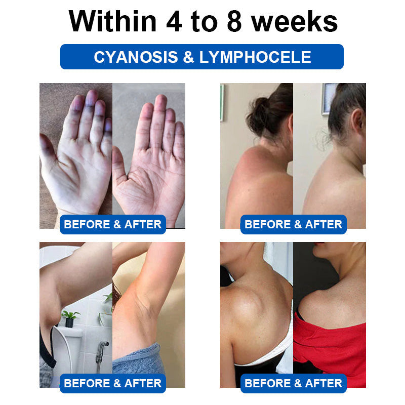 ✅HPRA Certified | 🍀GFOUK™ Ultrasonic Fat Blasting and Detoxing Wristband (🔥LAST DAY 70% OFF)