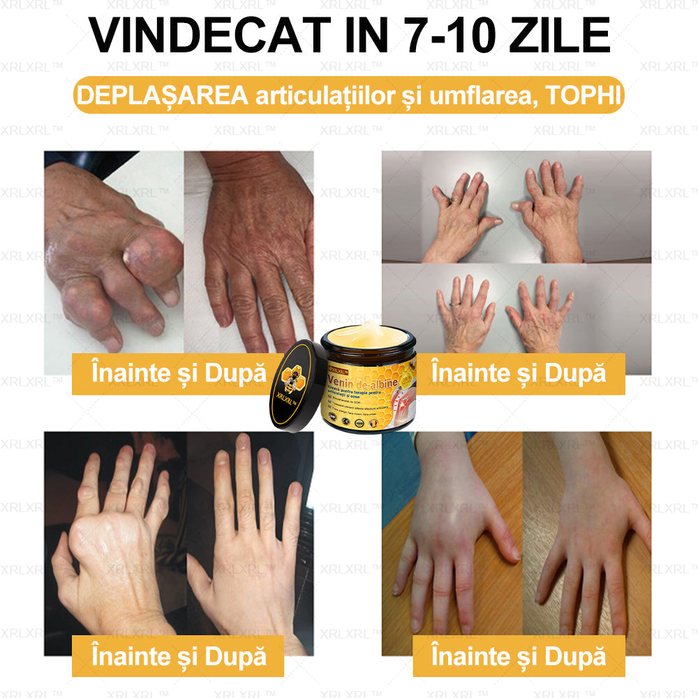 XRLXRL™ csontgyógyító méhméreg fájdalomcsillapító krém (kifejezetten idősebb felnőttek számára, az AAOS által ajánlott)