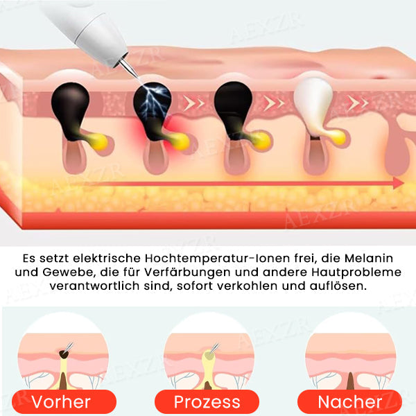 FivfivgoTM hordozható bőrápoló lézertoll