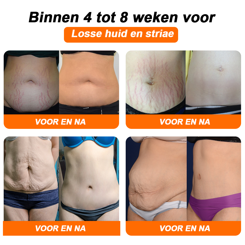 💃💃 KkioTM negatív ionos zsírégető, hasfeszesítő, 👑Detox alakformáló nadrág