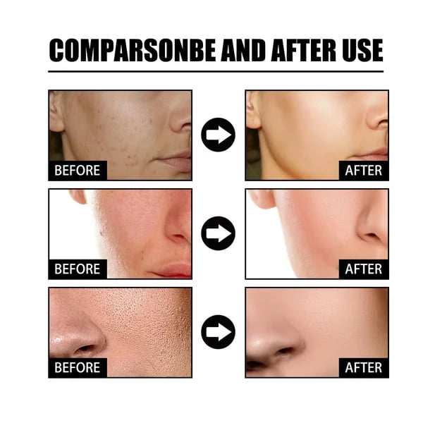 ✨E HETI AKCIÓS ÁRA A NIACINAMIDE ARCESSZENCIA💖