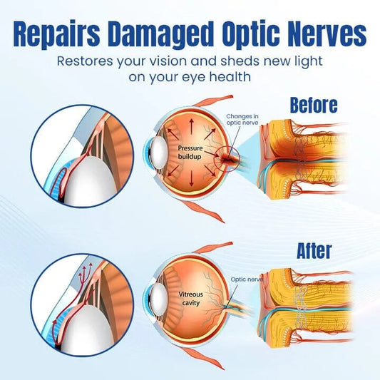 CEOERTYTM OPTIRENEW SZEMÁPOLÓ CSEPPEK