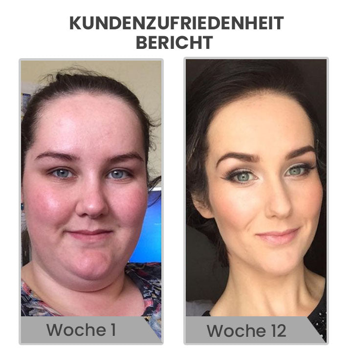 Oveallgo™ Astennu Beauty Lymphvity Auriculotherapy White Onyx fülmandzsetta