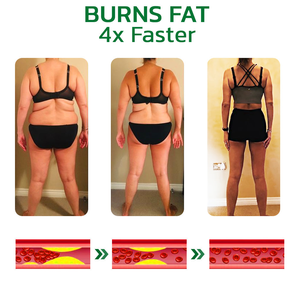 GFOUK™ GingerLegs Anti Swelling Méregtelenítő Kenőcs