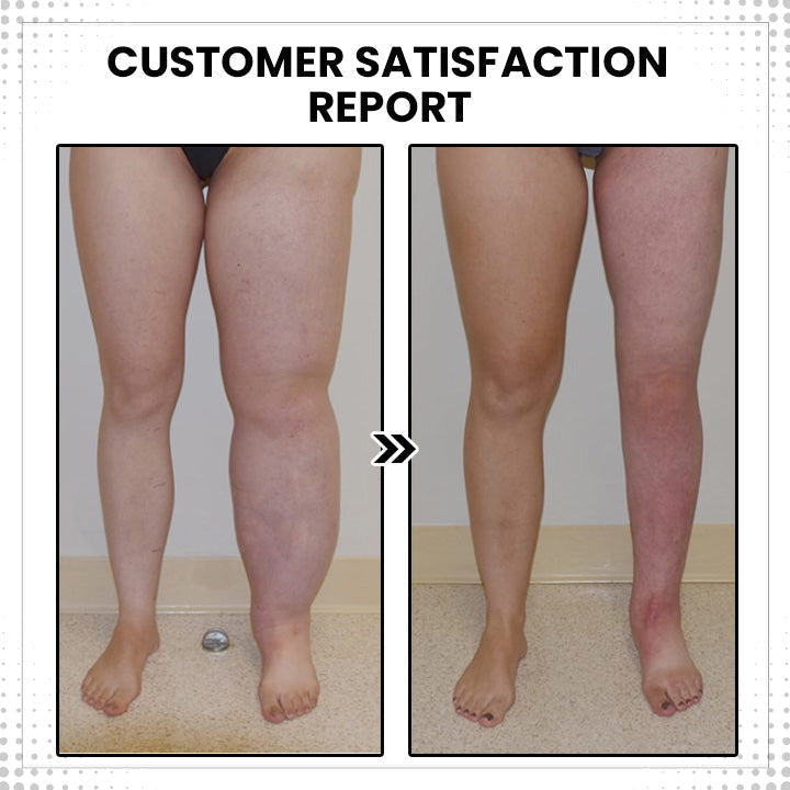 Háromgyűrűs JANSIO Treanic mágneses spinterápia