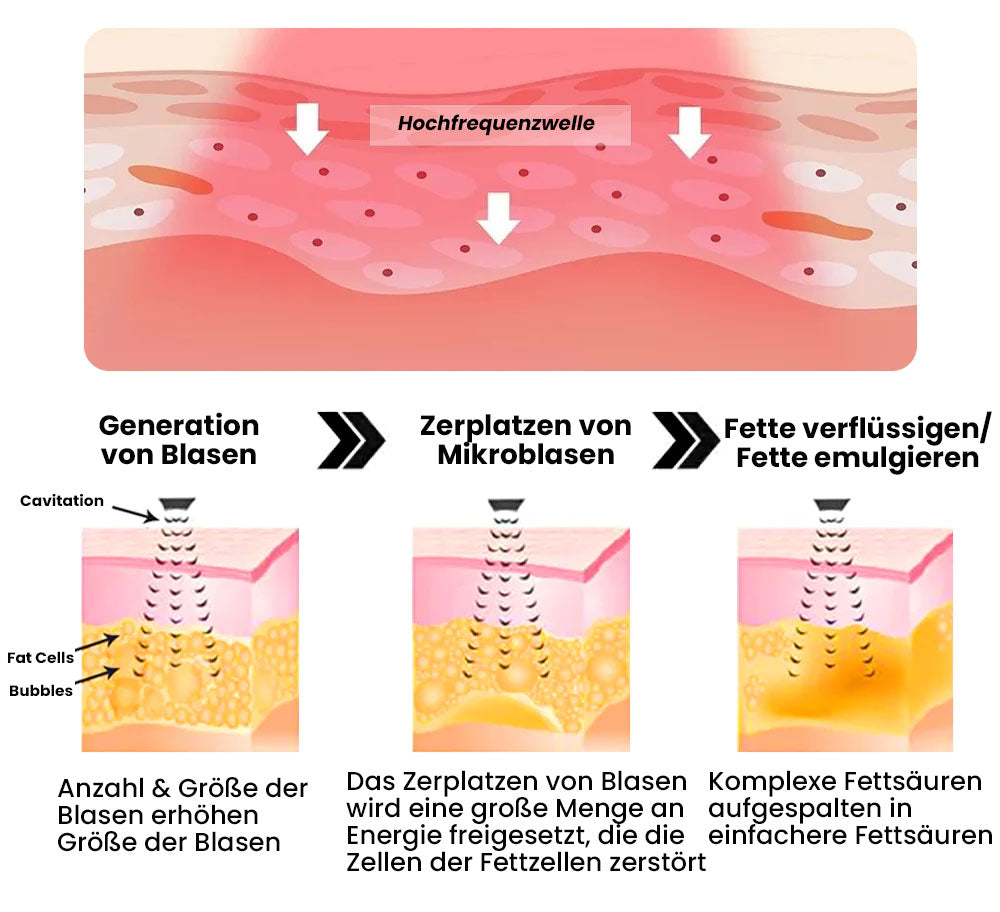 Oveallgo™ ToneX professzionális challhäufigkeit fitt szalag az alakformáláshoz.