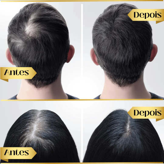 95%-os csökkenés csökkenés, 20x növekedés növekedés | Fix Your Hair®