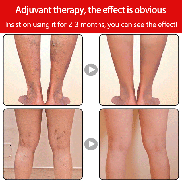 IONFIT™ TISZTÍTÓ ÉS MÉREGTELENÍTŐ VIRÁGZOKNI